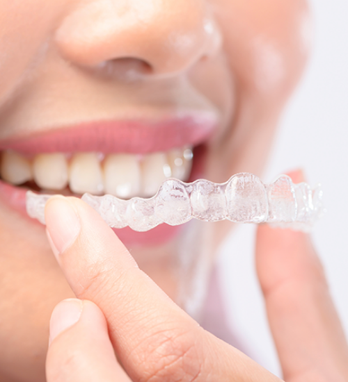 Orthodontie Invisible par aligneurs